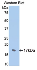 CDH2 / N Cadherin Antibody - Western blot of CDH2 / N Cadherin antibody.