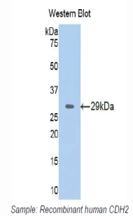 CDH2 / N Cadherin Antibody - Western blot of recombinant CDH2 / N Cadherin.  This image was taken for the unconjugated form of this product. Other forms have not been tested.