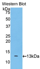 CDH2 / N Cadherin Antibody - Western blot of CDH2 / N Cadherin antibody.