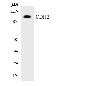CDH2 / N Cadherin Antibody - Western blot analysis of the lysates from HT-29 cells using CDH2 antibody.