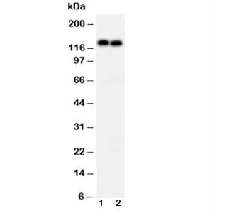 CDH2 / N Cadherin Antibody - Western blot testing of N-Cadherin antibody and Lane 1: MCF-7; 2: HeLa cell lysate