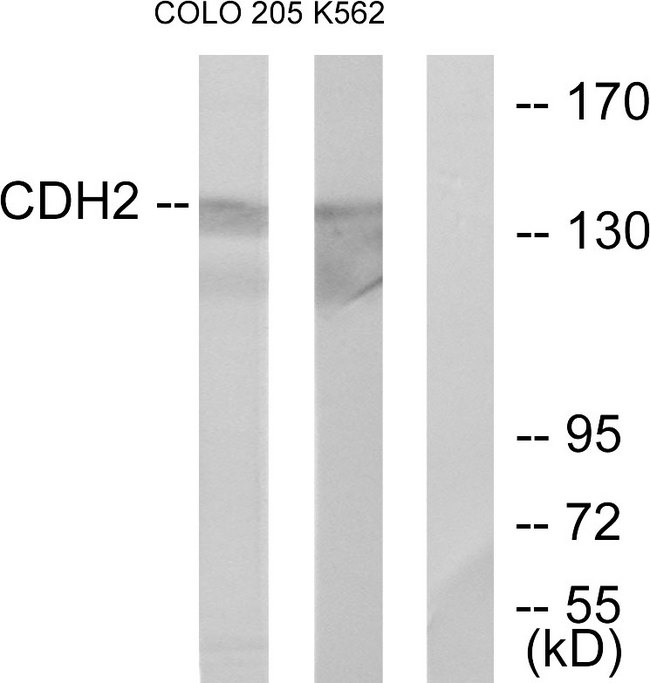 CDH2 / N Cadherin Antibody - Western blot analysis of lysates from COLO205 and K562 cells, using CDH2 Antibody. The lane on the right is blocked with the synthesized peptide.