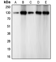 CDH2 / N Cadherin Antibody - Western blot analysis of CD325 expression in A549 (A); mouse brain (B); rat brain (C); A10 (D); PC12 (E) whole cell lysates.