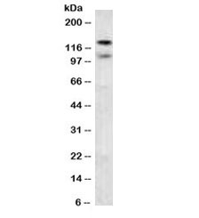 CDH2 / N Cadherin Antibody - Western blot testing of human brain lysate with CDH2 antibody. Predicted molecular weight ~100 kDa (unmodified), 125-140 kDa (modified).