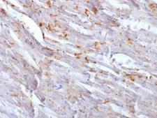 CDH2 / N Cadherin Antibody - IHC testing of FFPE mouse heart with Cadherin 2 antibody (clone CDH2/1573). Required HIER: boil tissue sections in 10mM Tis with1mM EDTA, pH 9, for 10-20 min.