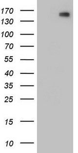 CDH2 / N Cadherin Antibody - HEK293T cells were transfected with the pCMV6-ENTRY control (Left lane) or pCMV6-ENTRY CDH2 (Right lane) cDNA for 48 hrs and lysed. Equivalent amounts of cell lysates (5 ug per lane) were separated by SDS-PAGE and immunoblotted with anti-CDH2.