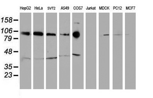 CDH2 / N Cadherin Antibody - Western blot of extracts (35 ug) from 9 different cell lines by using anti-CDH2 monoclonal antibody.