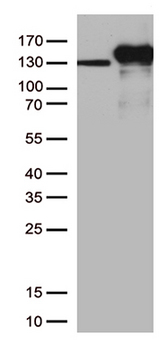 CDH2 / N Cadherin Antibody - Western Blot analysis of extracts. (35µg) from 11 different cell lines by using anti-CDH2 monoclonal antibody. (Clone UMAB23)