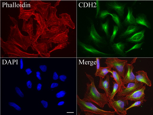 CDH2 / N Cadherin Antibody - Immunofluorescent staining of HeLa cells using anti-CDH2 mouse monoclonal antibody  green, 1:50). Actin filaments were labeled with Alexa Fluor® 594 Phalloidin. (red), and nuclear with DAPI. (blue). Scale bar, 20µm.