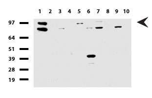 CDH2 / N Cadherin Antibody - Western blot of human tissue lysates. (15ug) from 10 different tissues. (1: Testis, 2: Omentum, 3: Uterus, 4: Breast, 5: Brain, 6: Liver, 7: Ovary, 8: Thyroid, 9: Colon, 10: Spleen ). Diluation: 1:500.