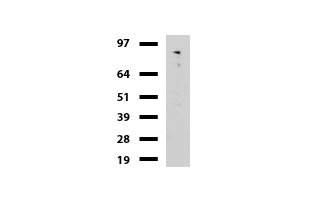 CDH2 / N Cadherin Antibody - Western blot of mouse tissue lysates. (20ug) from Brain. Primary antibody diluation: 1:500. Secondary antibody dilution: Mouse TrueBlot® Ultra. (1:1000).