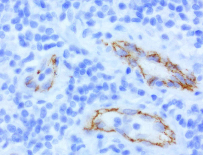 CDH2 / N Cadherin Antibody - Immunohistochemical staining of paraffin-embedded of human lymph node using anti-CDH2 clone UMAB23 mouse monoclonal antibody at 1:400 dilution of 1.0mg/mL using Polink2 Broad HRP DAB detection kit.requires heat-induced epitope retrieval with Citrate pH6.0 in a pressure chamber/cooker high 3min. The image shows cells of the lymph node are negative. Positive staining seen in the endothelial cells, mostly membraneous with weak cytoplasmic .