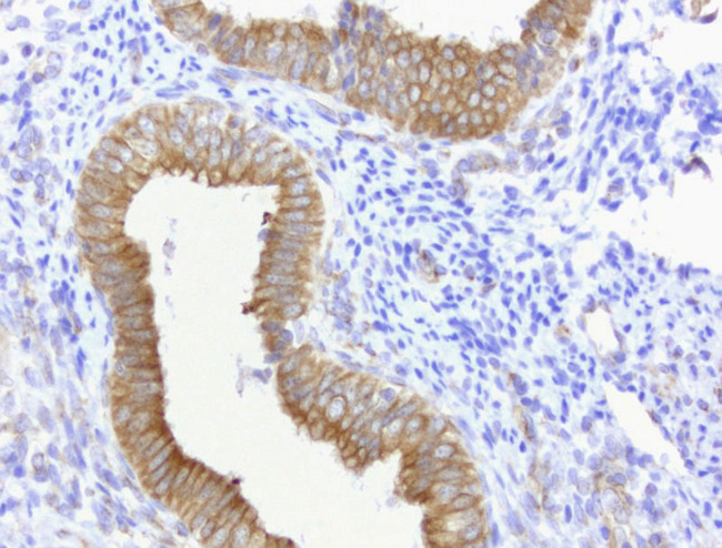 CDH2 / N Cadherin Antibody - Immunohistochemical staining of paraffin-embedded of human endometrium using anti-CDH2 clone UMAB23 mouse monoclonal antibody at 1:400 dilution of 1.0mg/mL using Polink2 Broad HRP DAB detection kit.requires heat-induced epitope retrieval with Citrate pH6.0 in a pressure chamber/cooker high 3min. The image shows strong membranous and cytoplsamic staining of the endometrial cells.