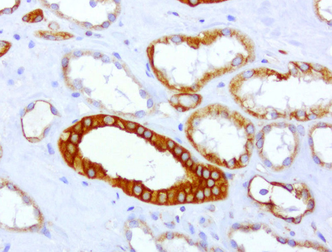 CDH2 / N Cadherin Antibody - Immunohistochemical staining of paraffin-embedded of human kidney using anti-CDH2 clone UMAB23 mouse monoclonal antibody at 1:400 dilution of 1.0mg/mL using Polink2 Broad HRP DAB detection kit.requires heat-induced epitope retrieval with Citrate pH6.0 in a pressure chamber/cooker high 3min. The image shows strong membranous and cytoplsamic staining in the kidney tubules