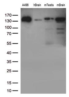 CDH2 / N Cadherin Antibody - Western blot analysis of extracts. (35ug) from cell line and tissues by using anti-CDH2 monoclonal antibody. (1:500)
