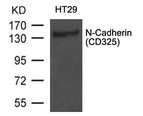 CDH2 / N Cadherin Antibody - Western blot of extract of HT29 cells using N-Cadherin antibody