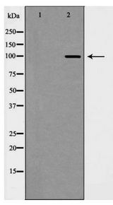 CDH2 / N Cadherin Antibody - Western blot of CDH2 expression in Jurkat cells