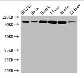 CDH2 / N Cadherin Antibody - Positive WB detected in:HEK293 whole cell lysate,Hela whole cell lysate,Mouse heart tissue,Mouse liver tissue,Mouse brain tissue,Mouse kidney tissue;All lanes: CDH2 antibody at 3ug/ml;Secondary;Goat polyclonal to rabbit IgG at 1/50000 dilution;Predicted band size: 100,98 kDa;Observed band size: 100 kDa;