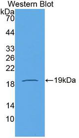 CDH2 / N Cadherin Antibody - Western blot of CDH2 / N Cadherin antibody.