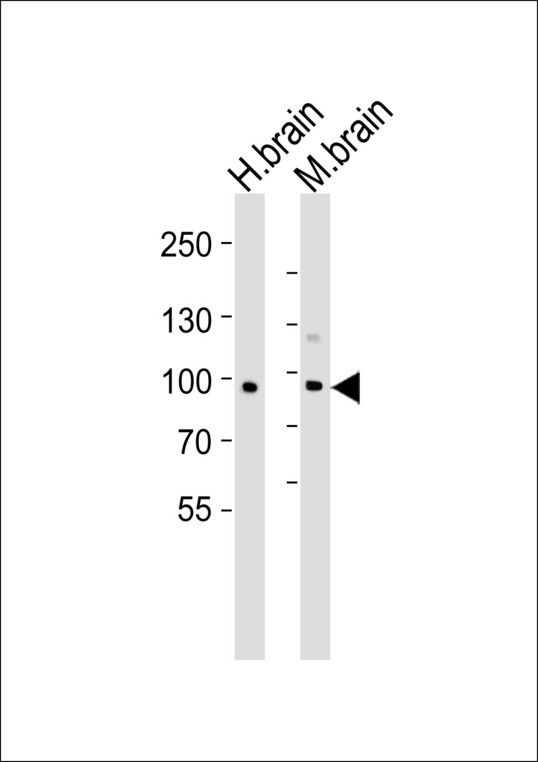 CDH20 / Cadherin 20 Antibody - Western blot of lysates from human brain and mouse brain tissue lysate(from left to right), using CDH20 Antibody. Antibody was diluted at 1:1000 at each lane. A goat anti-rabbit IgG H&L (HRP) at 1:5000 dilution was used as the secondary antibody. Lysates at 35ug per lane.