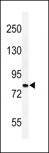 CDH20 / Cadherin 20 Antibody - Western blot of CDH20 Antibody in HepG2 cell line lysates (35 ug/lane). CDH20 (arrow) was detected using the purified antibody.