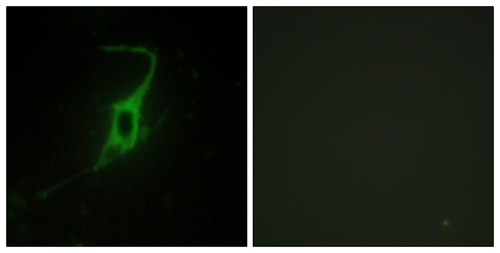 CDH20 / Cadherin 20 Antibody - Immunofluorescence analysis of NIH/3T3 cells, using CDH20 Antibody. The picture on the right is blocked with the synthesized peptide.
