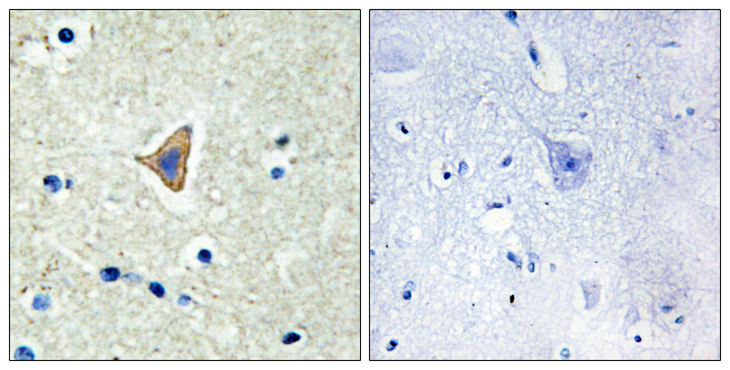 CDH20 / Cadherin 20 Antibody - Immunohistochemistry analysis of paraffin-embedded human brain tissue, using CDH20 Antibody. The picture on the right is blocked with the synthesized peptide.