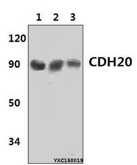 CDH20 / Cadherin 20 Antibody - Western blot of CDH20 antibody at 1:500 dilution. Lane 1: HeLa whole cell lysate (40 ug). Lane 2: The Liver tissue lysate of Rat(40 ug). Lane 3: The Liver tissue lysate of Mouse (40 ug).