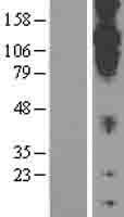 CDH20 / Cadherin 20 Protein - Western validation with an anti-DDK antibody * L: Control HEK293 lysate R: Over-expression lysate