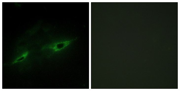 CDH22 / Cadherin 22 Antibody - Immunofluorescence analysis of NIH/3T3 cells, using CDH22 Antibody. The picture on the right is blocked with the synthesized peptide.