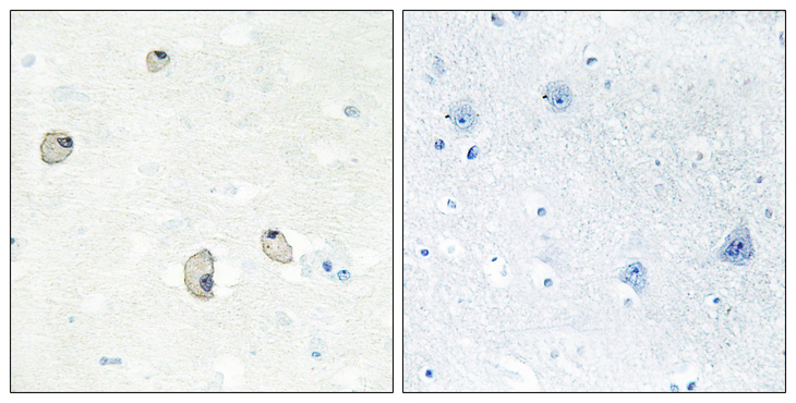 CDH22 / Cadherin 22 Antibody - Immunohistochemistry analysis of paraffin-embedded human brain tissue, using CDH22 Antibody. The picture on the right is blocked with the synthesized peptide.