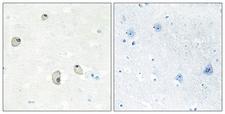 CDH22 / Cadherin 22 Antibody - Immunohistochemistry analysis of paraffin-embedded human brain tissue, using CDH22 Antibody. The picture on the right is blocked with the synthesized peptide.