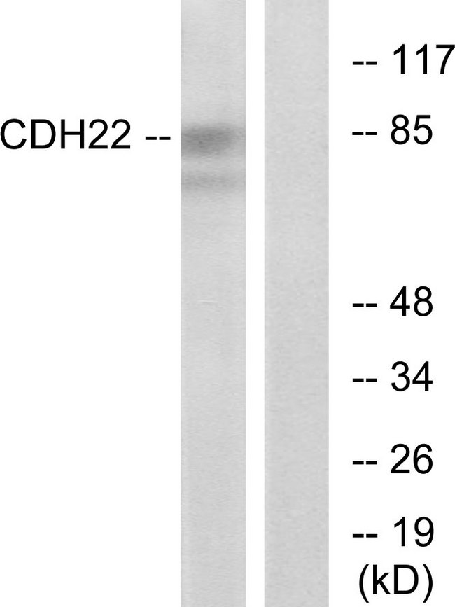 CDH22 / Cadherin 22 Antibody - Western blot analysis of lysates from rat brain cells, using CDH22 Antibody. The lane on the right is blocked with the synthesized peptide.