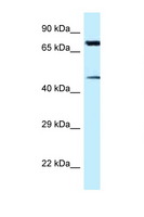 CDH22 / Cadherin 22 Antibody - CDH22 antibody Western blot of HeLa Cell lysate. Antibody concentration 1 ug/ml.  This image was taken for the unconjugated form of this product. Other forms have not been tested.