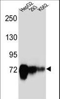 CDH22 / Cadherin 22 Antibody - CDH22 Antibody western blot of HepG2,293,K562 cell line lysates (35 ug/lane). The CDH22 antibody detected the CDH22 protein (arrow).
