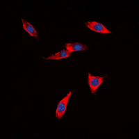 CDH22 / Cadherin 22 Antibody - Immunofluorescent analysis of PB Cadherin staining in HeLa cells. Formalin-fixed cells were permeabilized with 0.1% Triton X-100 in TBS for 5-10 minutes and blocked with 3% BSA-PBS for 30 minutes at room temperature. Cells were probed with the primary antibody in 3% BSA-PBS and incubated overnight at 4 deg C in a humidified chamber. Cells were washed with PBST and incubated with a DyLight 594-conjugated secondary antibody (red) in PBS at room temperature in the dark. DAPI was used to stain the cell nuclei (blue).