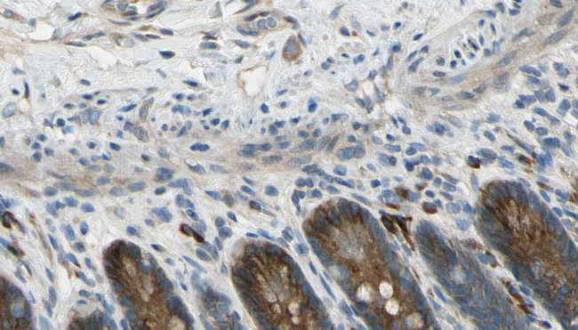 CDH22 / Cadherin 22 Antibody - 1:100 staining mouse intestine tissue by IHC-P. The sample was formaldehyde fixed and a heat mediated antigen retrieval step in citrate buffer was performed. The sample was then blocked and incubated with the antibody for 1.5 hours at 22°C. An HRP conjugated goat anti-rabbit antibody was used as the secondary.