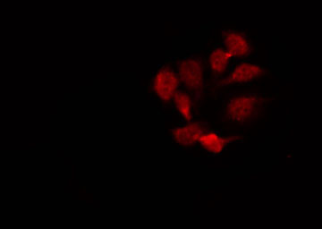 CDH22 / Cadherin 22 Antibody - Staining HepG2 cells by IF/ICC. The samples were fixed with PFA and permeabilized in 0.1% Triton X-100, then blocked in 10% serum for 45 min at 25°C. The primary antibody was diluted at 1:200 and incubated with the sample for 1 hour at 37°C. An Alexa Fluor 594 conjugated goat anti-rabbit IgG (H+L) Ab, diluted at 1/600, was used as the secondary antibody.