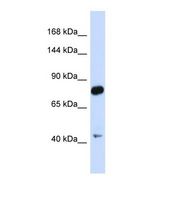 CDH23 / Cadherin 23 Antibody - Western blot of Human Fetal Brain. CDH23 antibody dilution 1.0 ug/ml.  This image was taken for the unconjugated form of this product. Other forms have not been tested.