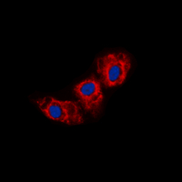 CDH23 / Cadherin 23 Antibody - Immunofluorescent analysis of Cadherin 23 staining in HEK293T cells. Formalin-fixed cells were permeabilized with 0.1% Triton X-100 in TBS for 5-10 minutes and blocked with 3% BSA-PBS for 30 minutes at room temperature. Cells were probed with the primary antibody in 3% BSA-PBS and incubated overnight at 4 C in a humidified chamber. Cells were washed with PBST and incubated with a DyLight 594-conjugated secondary antibody (red) in PBS at room temperature in the dark. DAPI was used to stain the cell nuclei (blue).