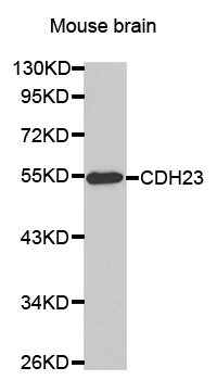 CDH23 / Cadherin 23 Antibody - Western blot analysis of extracts of mouse brain, using CDH23 antibody.
