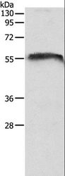 CDH23 / Cadherin 23 Antibody - Western blot analysis of Mouse brain tissue, using CDH23 Polyclonal Antibody at dilution of 1:1050.