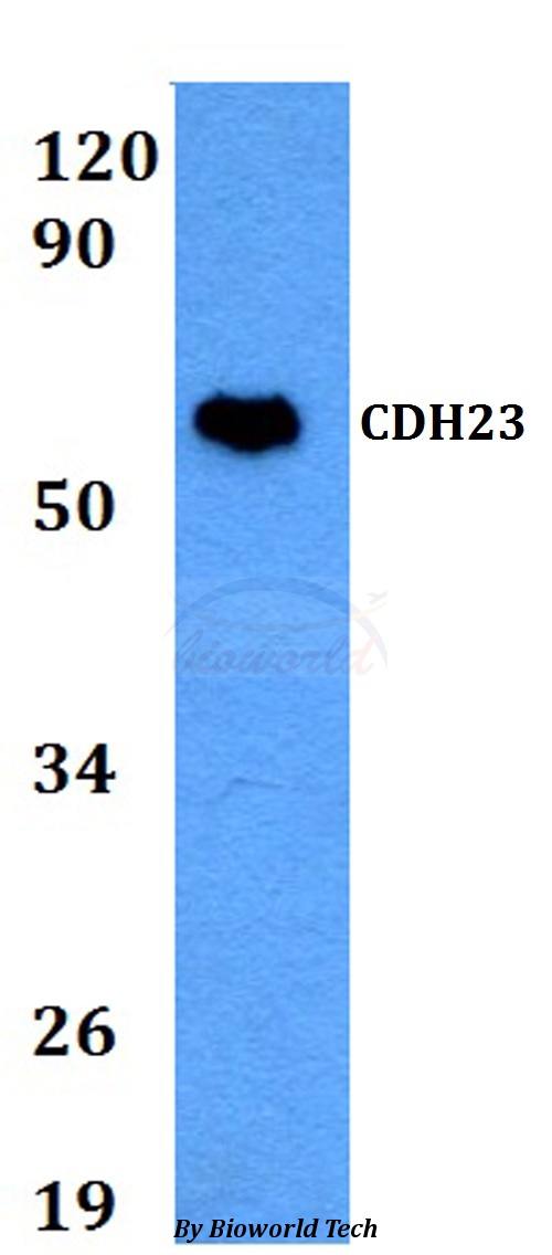 CDH23 / Cadherin 23 Antibody - Western blot of CDH23 antibody at 1:500 dilution. Lane 1: HEK293T whole cell lysate.