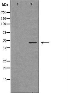 CDH23 / Cadherin 23 Antibody - Western blot analysis of extracts of mouse brain tissue using CDH23 antibody. The lane on the left is treated with the antigen-specific peptide.