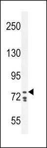 CDH24 / EY Cadherin Antibody - CDH24 Antibody western blot of K562 cell line lysates (35 ug/lane). The CDH24 antibody detected the CDH24 protein (arrow).