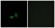 CDH24 / EY Cadherin Antibody - Immunofluorescence analysis of HepG2 cells, using CDH24 Antibody. The picture on the right is blocked with the synthesized peptide.