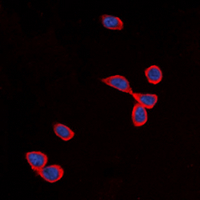 CDH24 / EY Cadherin Antibody - Immunofluorescent analysis of Cadherin 24 staining in SHSY5Y cells. Formalin-fixed cells were permeabilized with 0.1% Triton X-100 in TBS for 5-10 minutes and blocked with 3% BSA-PBS for 30 minutes at room temperature. Cells were probed with the primary antibody in 3% BSA-PBS and incubated overnight at 4 deg C in a humidified chamber. Cells were washed with PBST and incubated with a DyLight 594-conjugated secondary antibody (red) in PBS at room temperature in the dark. DAPI was used to stain the cell nuclei (blue).