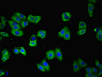 CDH3 / P-Cadherin Antibody - Immunofluorescent analysis of HepG2 cells using CDH3 Antibody at dilution of 1:100 and Alexa Fluor 488-congugated AffiniPure Goat Anti-Rabbit IgG(H+L)