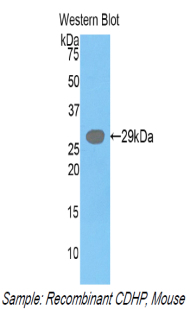CDH3 / P-Cadherin Antibody - Western blot of recombinant CDH3 / P-Cadherin.  This image was taken for the unconjugated form of this product. Other forms have not been tested.