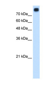CDH3 / P-Cadherin Antibody - CDH3 / P Cadherin antibody ARP45170_T100-NP_001784-CDH3(cadherin 3, type 1, P-cadherin (placental)) Antibody Western blot of HepG2 cell lysate.  This image was taken for the unconjugated form of this product. Other forms have not been tested.